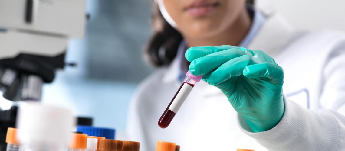 Lymphopénie : comprendre la baisse des lymphocytes et ses causes